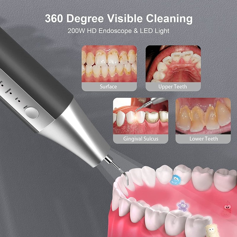 Oraly Tooth Visualization Dental Cleaning Tools Ultrasonic